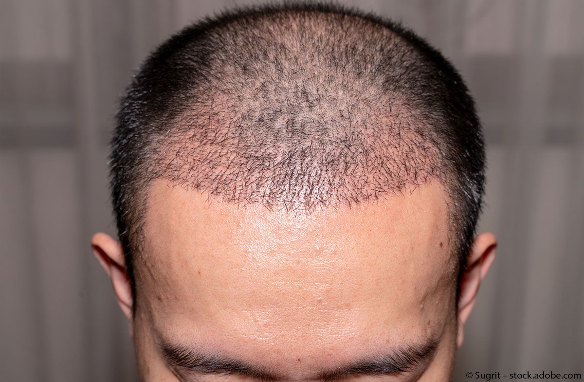 hairzstueck-friseur-boys