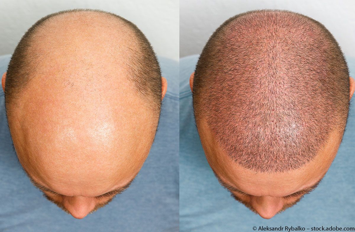 hairzstueck-friseur-boys