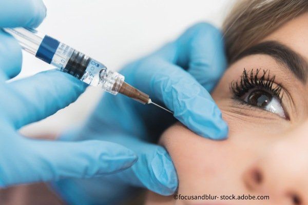Unterspritzung mit Hyaluronsäure
