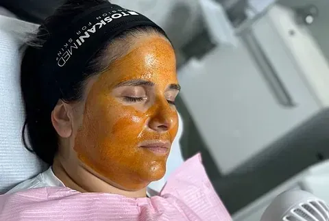 Una mujer está acostada en una cama con una mascarilla facial en la cara.
