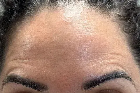 Un primer plano de la frente de una mujer con arrugas y cejas.