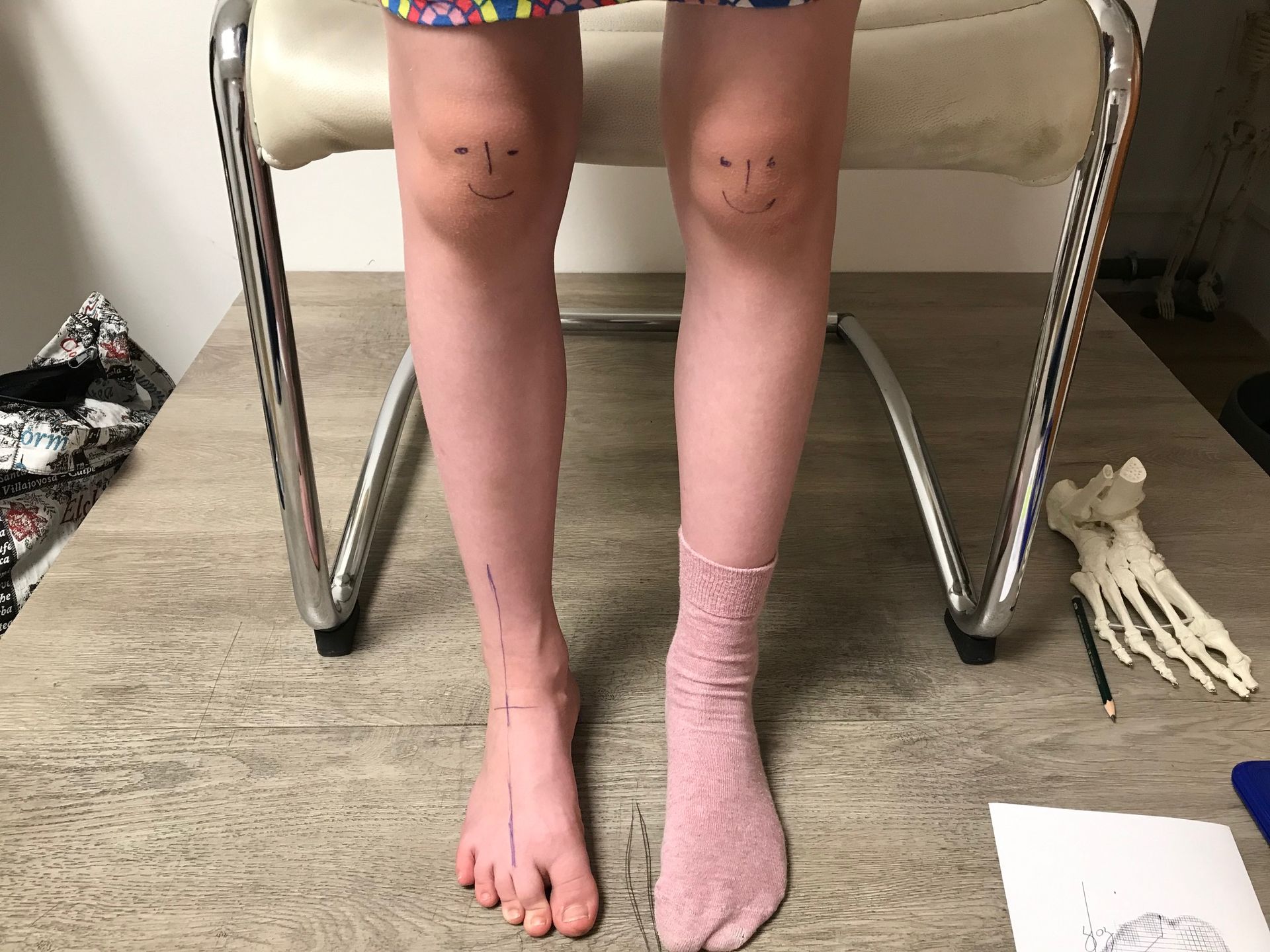 Mädchen mit gerader Kniestellung, auf den Knien sind lachende Gesichter gezeichnet.