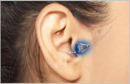 Ακουστικά Βαρηκοΐας ΧΟΛΕΒΑΣ Κ. - ΤΖΗΜΑΣ Γ. Ο.Ε.