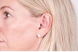 Ακουστικά Βαρηκοΐας ΧΟΛΕΒΑΣ Κ. - ΤΖΗΜΑΣ Γ. Ο.Ε.