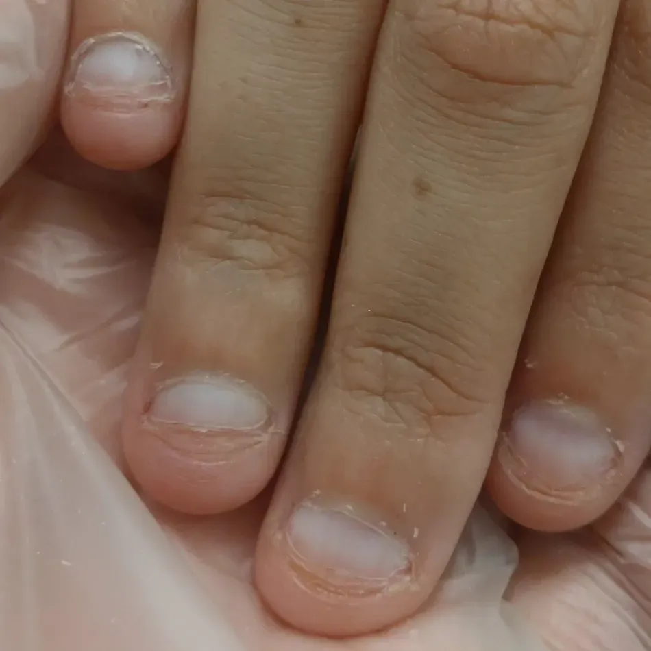 Primer plano de varios dedos con uñas cortas y recortadas que descansan sobre un guante translúcido.