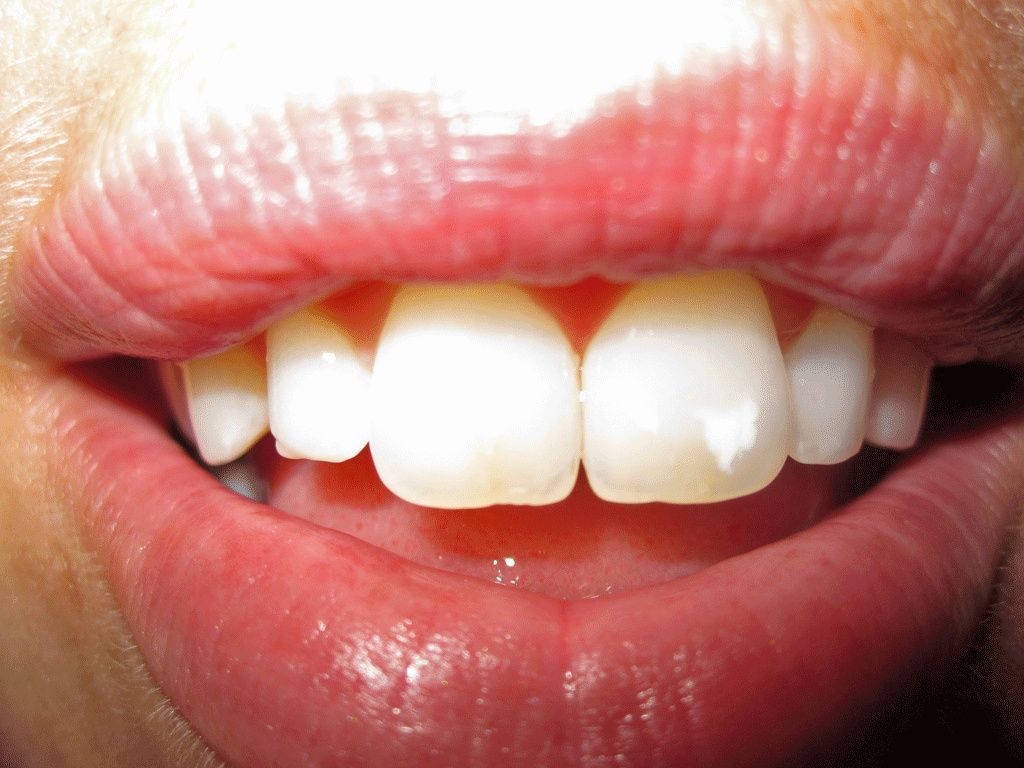 Prothese - Dentaltechnik G. Stutzer - Altdorf