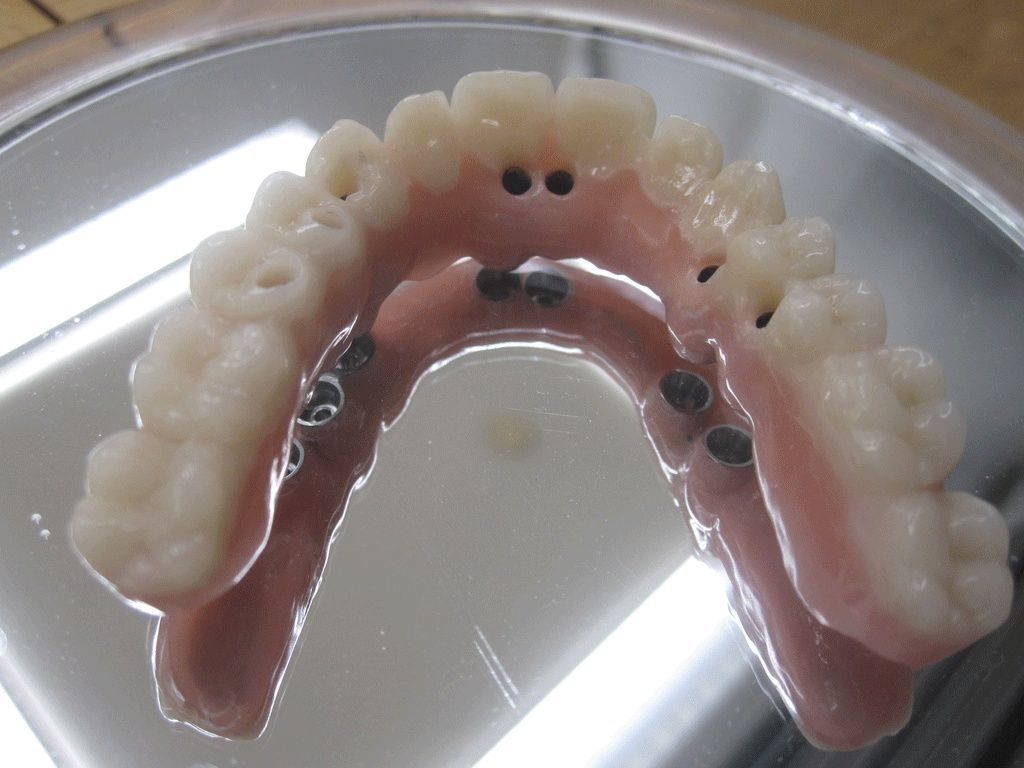 Zähne - Dentaltechnik G. Stutzer - Altdorf