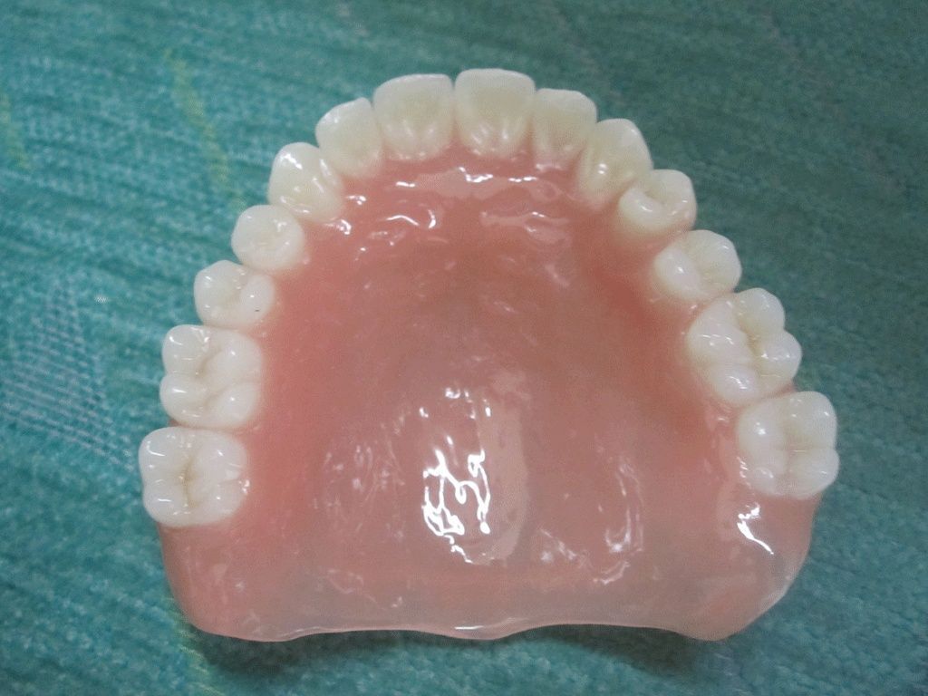 Totalprothese - Dentaltechnik G. Stutzer - Altdorf