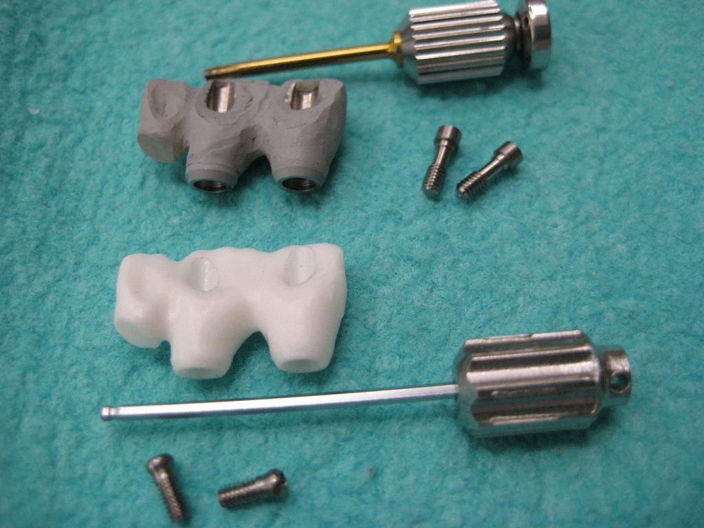 Zirkongerüst - Dentaltechnik G. Stutzer - Altdorf