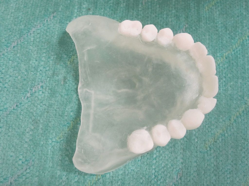 Bohrschablone ungebohrt - Dentaltechnik G. Stutzer - Altdorf