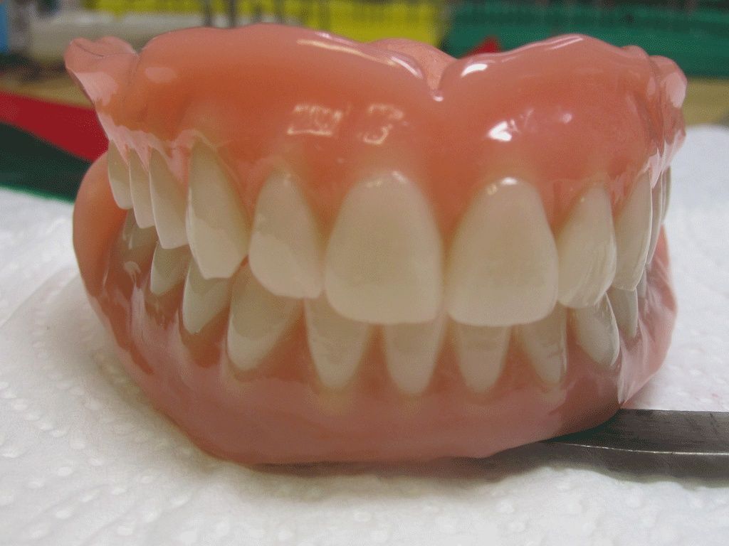 Oberkiefer & Unterkieferprothese - Dentaltechnik G. Stutzer - Altdorf