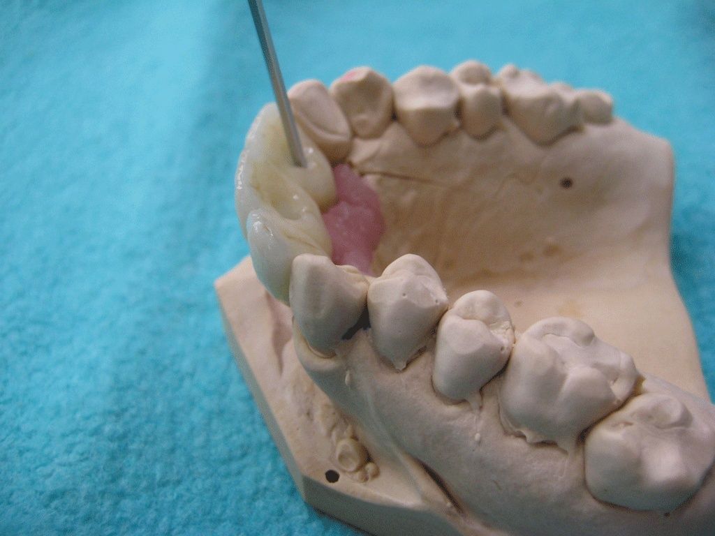 Dentaltechnik G. Stutzer - Altdorf UR