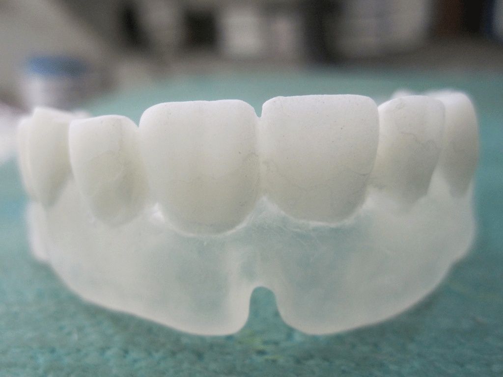 Bohrschablone ungebohrt - Dentaltechnik G. Stutzer - Altdorf