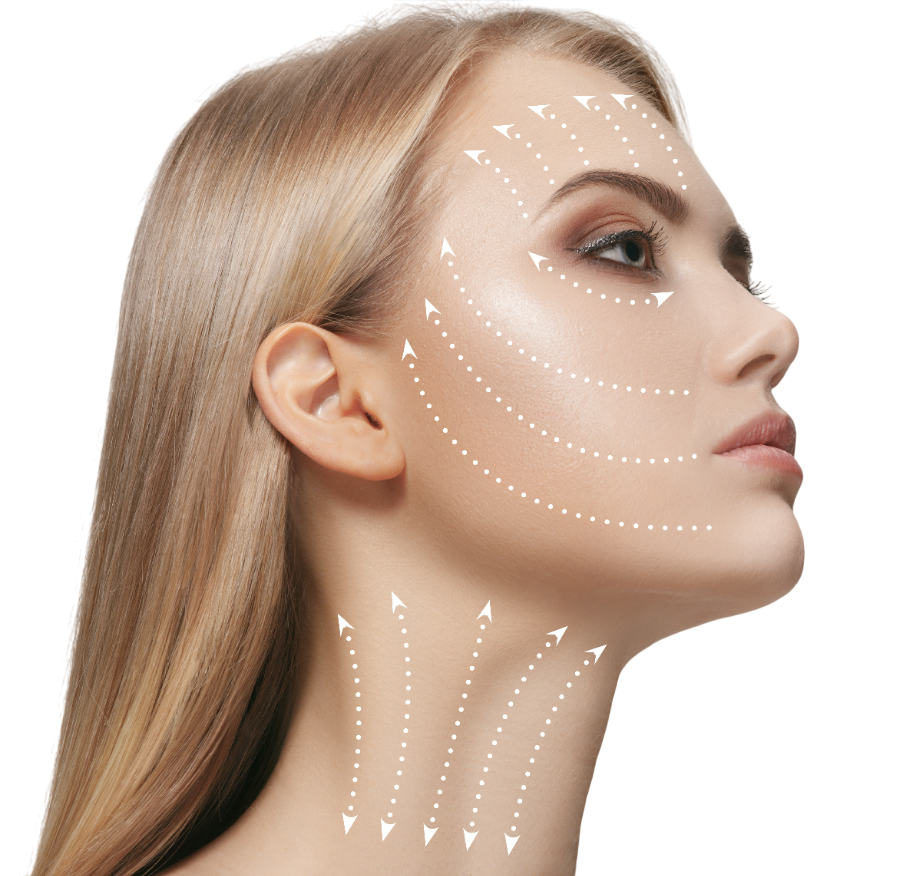 Visage de femme avec des flèches en pointillés indiquant les zones à traiter.