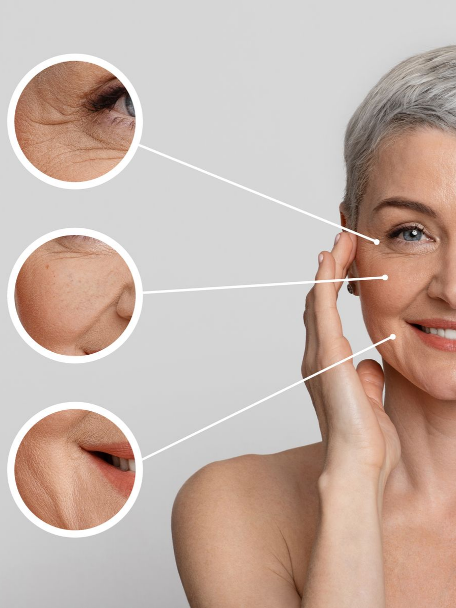 Visage de femme avec des rides mises en évidence par des cercles.