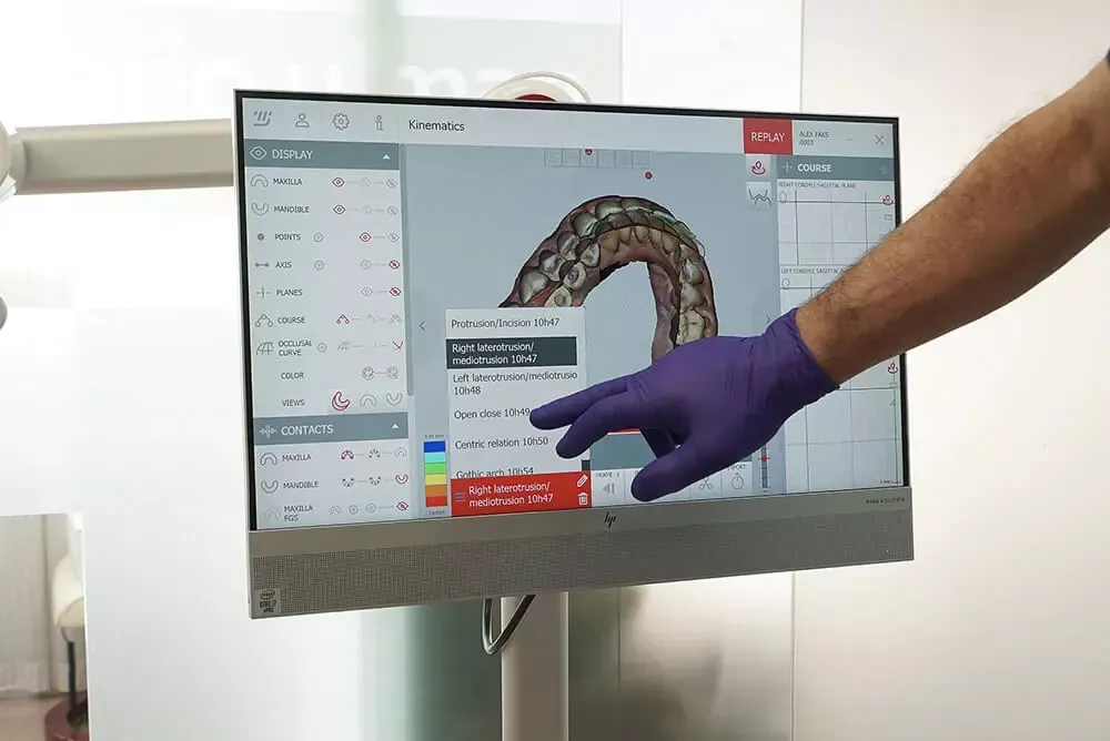 Una mano enguantada señala una exploración anatómica en 3D en un monitor táctil.