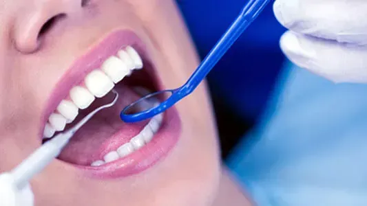 Un dentista realizando un examen bucal con un espejo dental azul y un instrumento de succión.