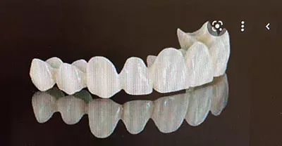 Un puente dental blanco con una hilera de dientes artificiales interconectados, sobre un fondo oscuro reflectante.