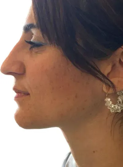 Primer plano de perfil de una persona con cabello oscuro, mirando al frente con expresión neutra.
