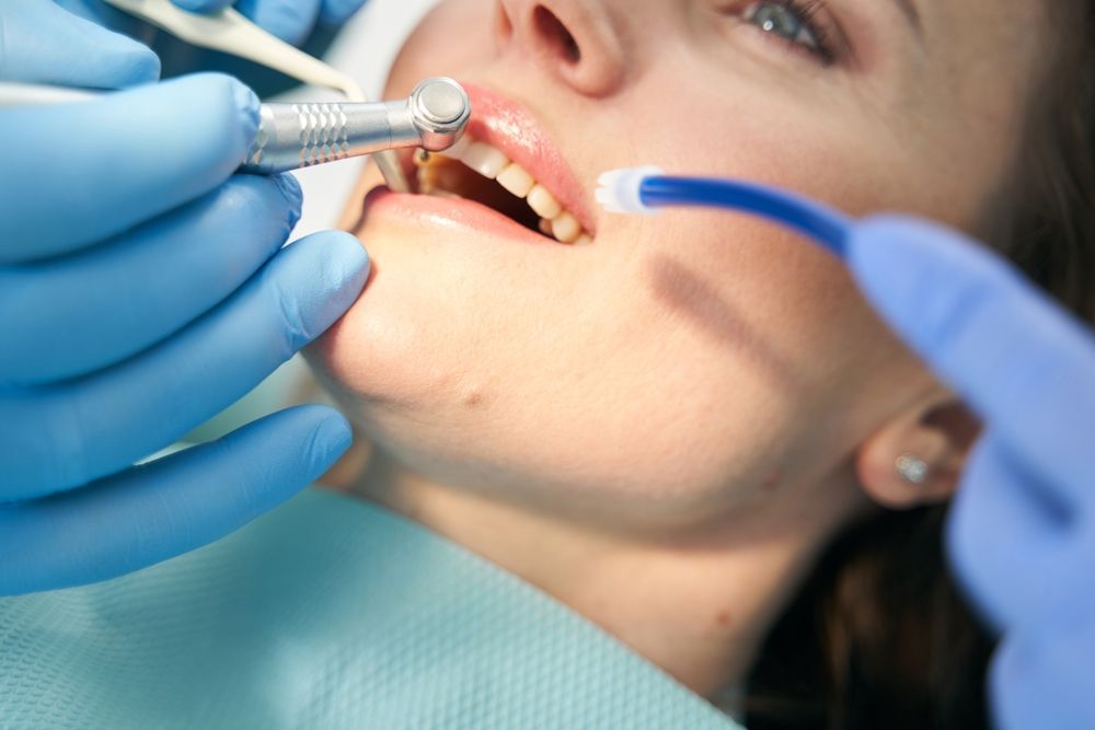 Un profesional dental con guantes azules realiza un procedimiento en los dientes de un paciente utilizando un taladro y un instrumento de succión.