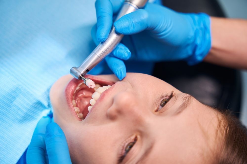 Un profesional dental, con guantes azules, utiliza una pieza de mano para pulir los dientes de un paciente durante una revisión dental.