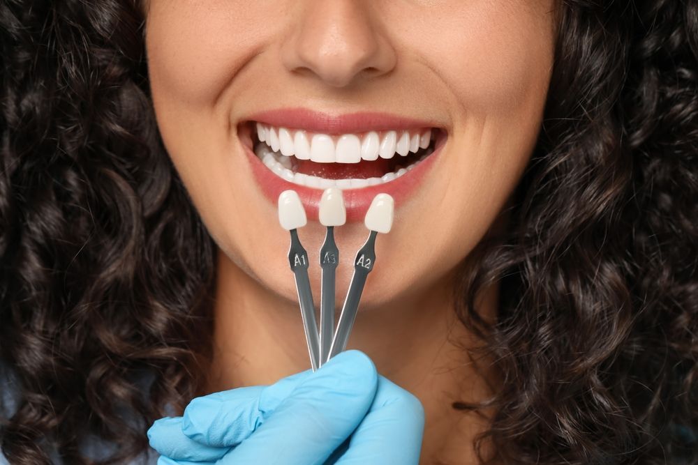 Una mano enguantada sostiene unas guías de color delante de los dientes de la persona para que coincidan con el color natural de sus dientes.