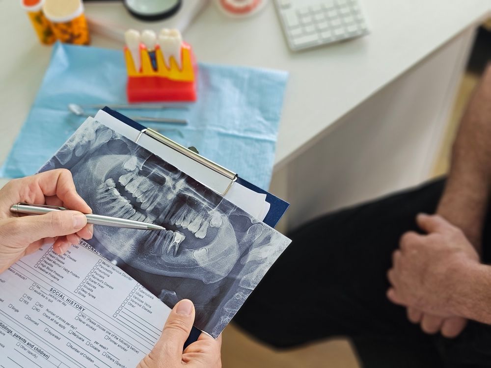 Durante una consulta, un dentista señala en un portapapeles la radiografía panorámica dental de un paciente.