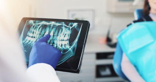 Durante una consulta, un dentista que lleva guantes médicos azules señala una radiografía dental que se muestra en una tableta.