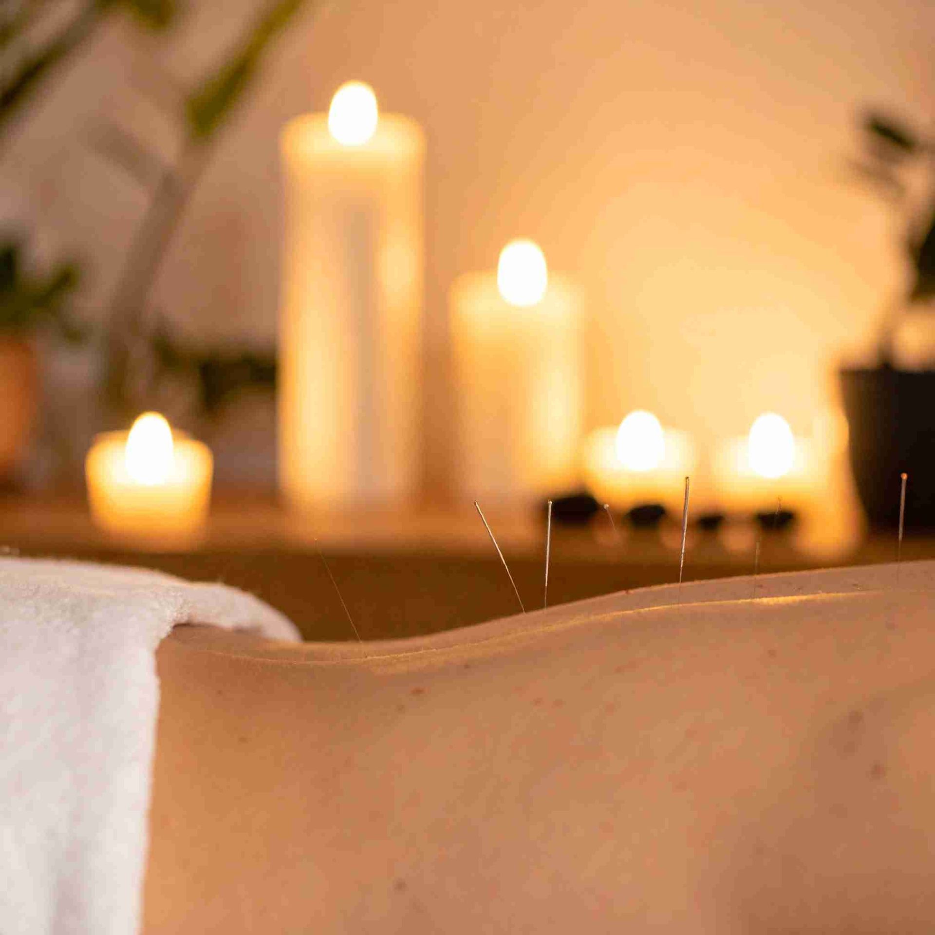 Espalda de una persona recibiendo acupuntura, con velas de fondo.