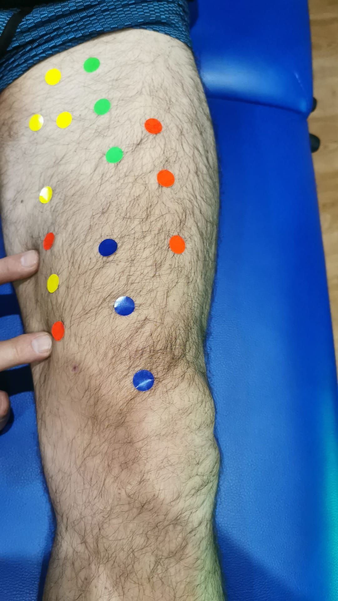 Pierna con pegatinas de colores. Los dedos señalan las pegatinas.