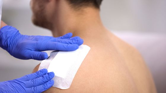 Des mains gantées appliquent un pansement adhésif blanc sur le haut du dos nu d'une personne