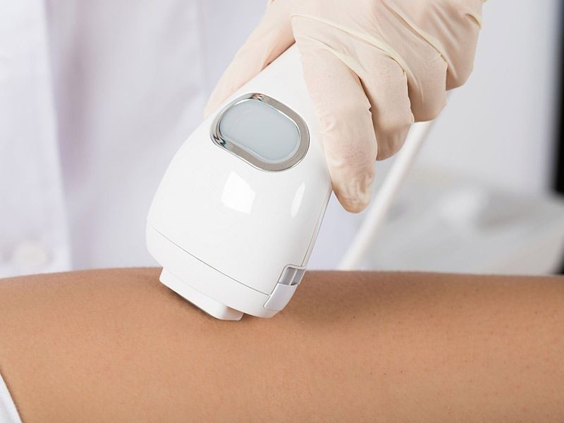 Mano en guante utilizando dispositivo de depilación láser en la pierna.