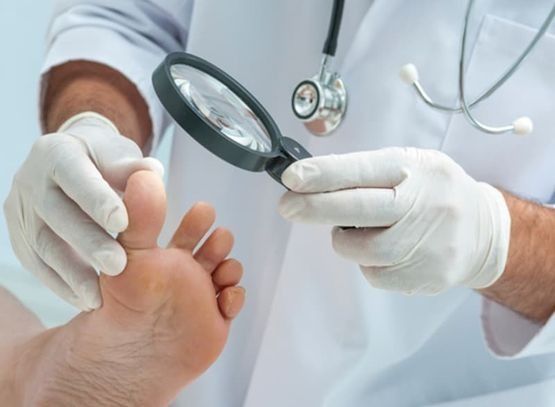 Doctor examinando un pie con una lupa.