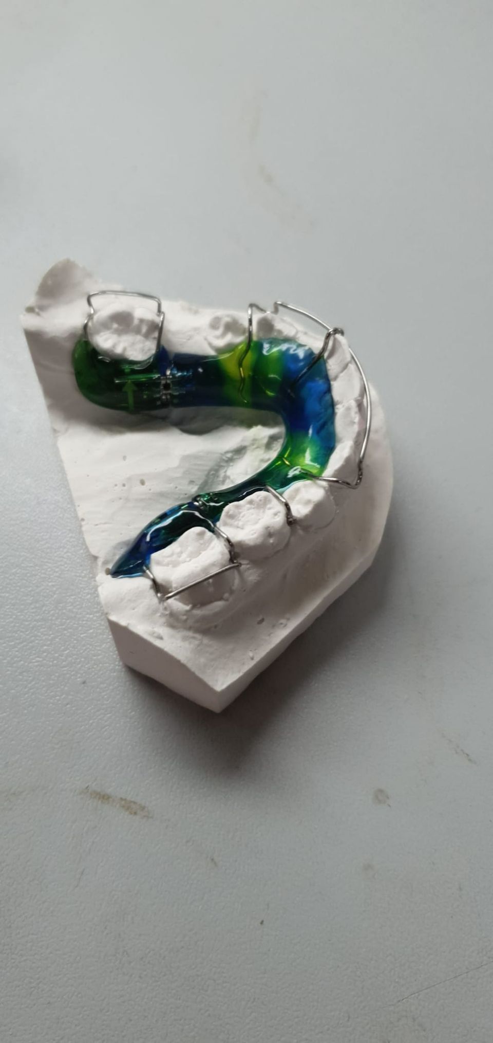 Zahnprothese von Dental Labor