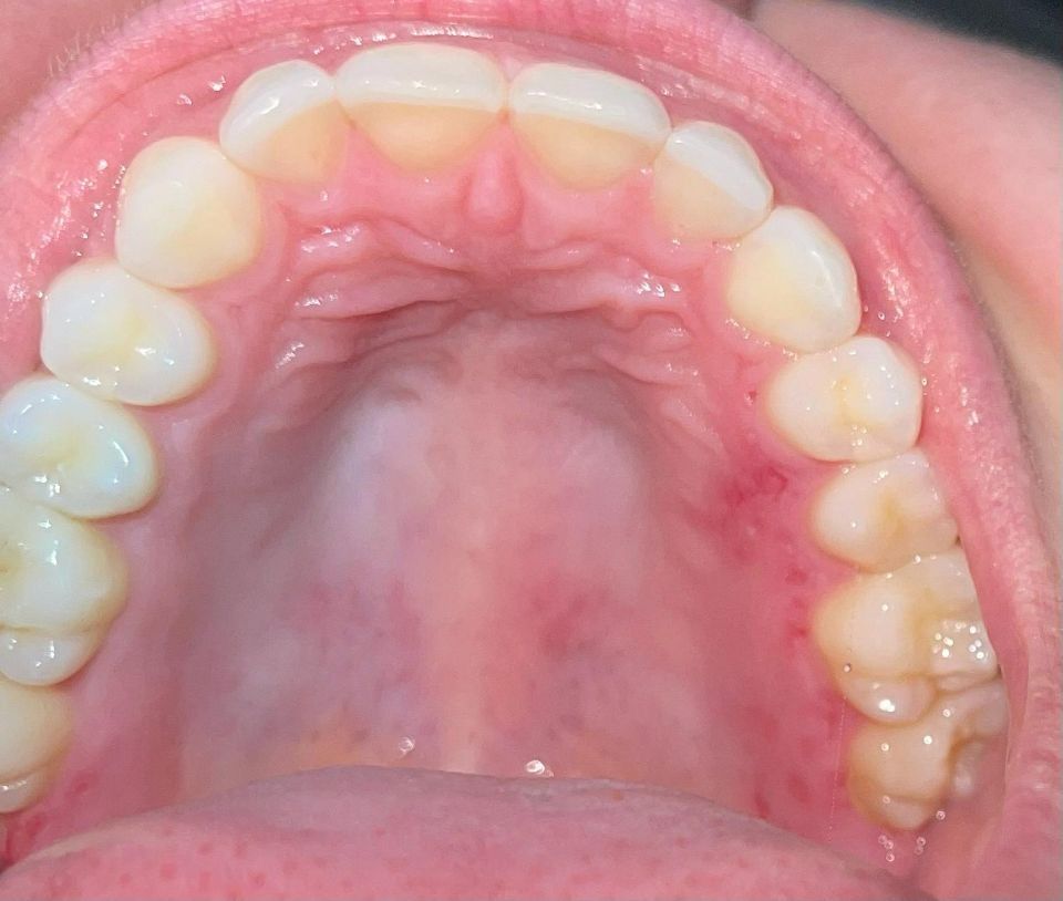 Mund/Unterkiefer von innen bei Dental Labor