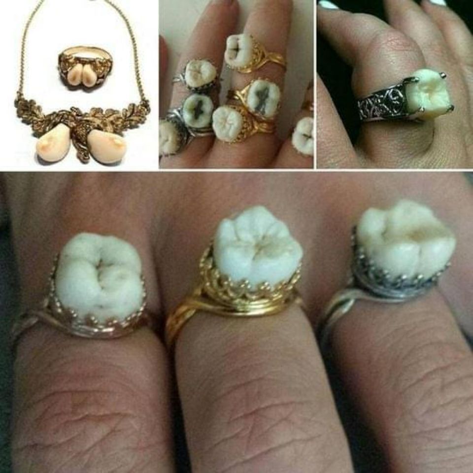 Zu Schmuck verarbeitete Zähne