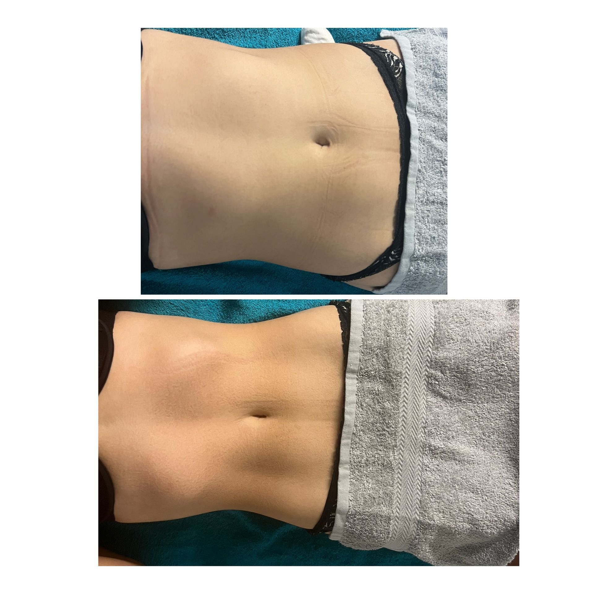 Eymen Coiffeur & Beauty GmbH – Bauchschlank-Kur
