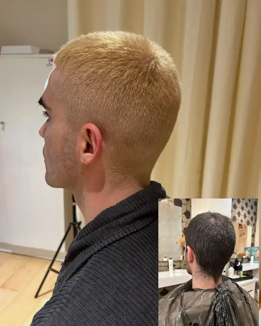 Hombre con cabello rubio teñido, vista lateral. El recuadro muestra la parte posterior de su cabeza con el cabello  original.