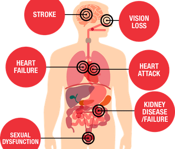 Diagrama del cuerpo humano que muestra diferentes tipos de enfermedades.
