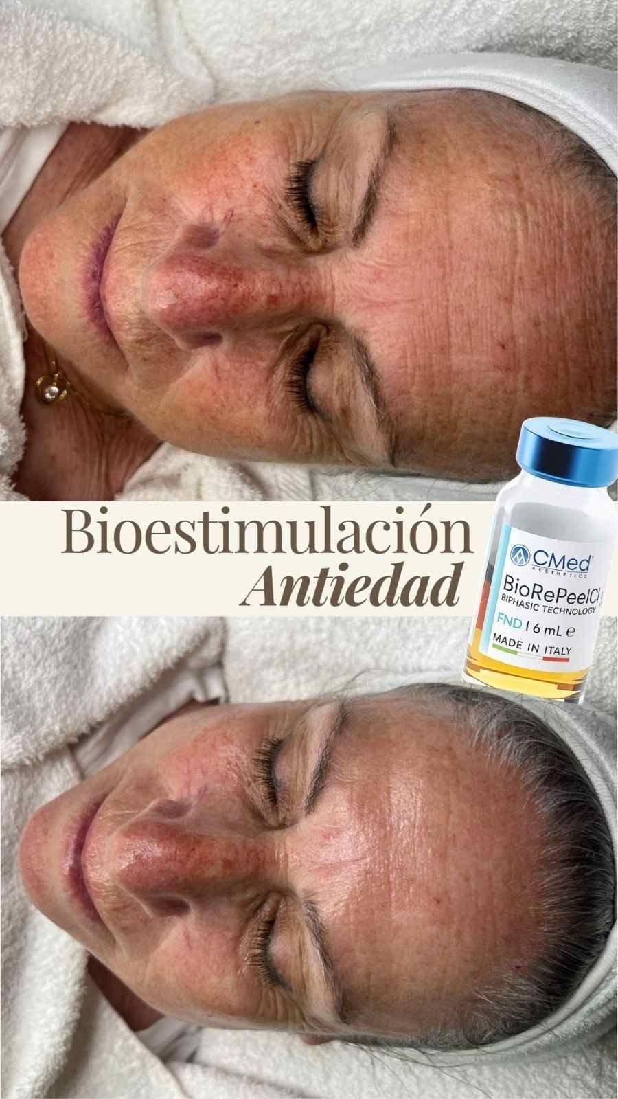 Promoción de un tratamiento facial que muestra un