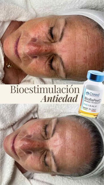 Promoción de un tratamiento facial que muestra un 