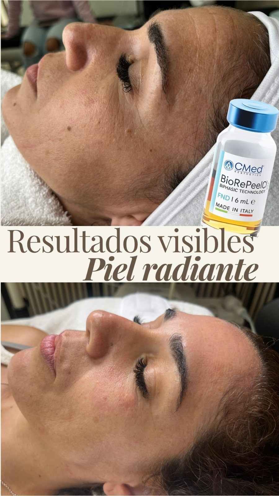 Resultados del antes y el después del cuidado facial con un frasco de crema y el texto