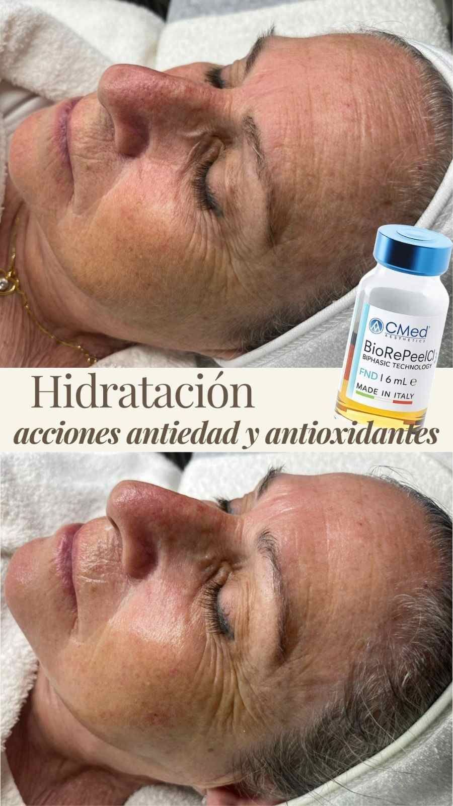 Comparación de rostro con hidratación facial, antes y después, con frasco de tratamiento en la esquina