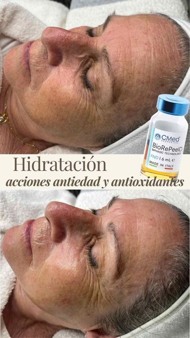 Comparación de rostro con hidratación facial, antes y después, con frasco de tratamiento en la esquina