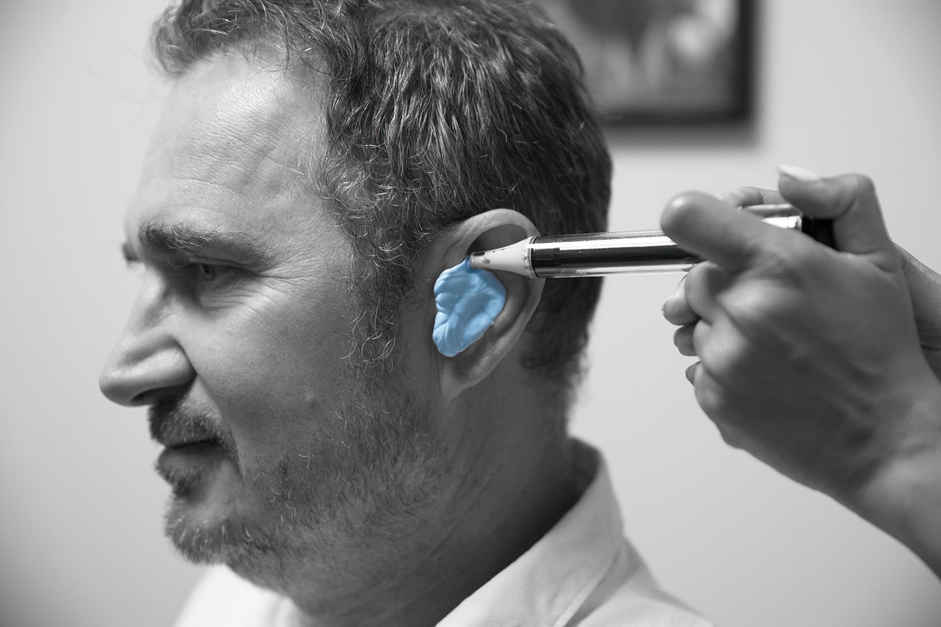 Moulage avec une pâte bleue dans l'oreille d'un patient