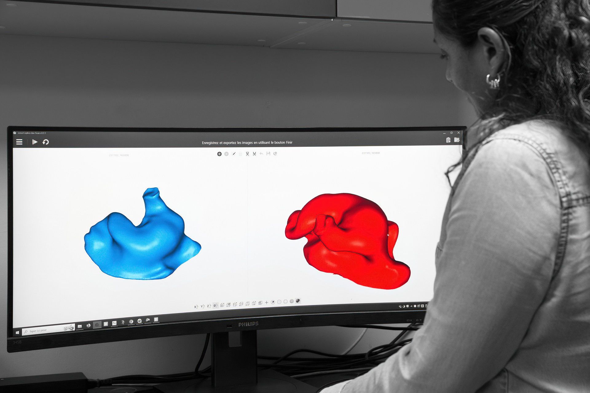 Image 3D des prothèses oreilles sur mesure