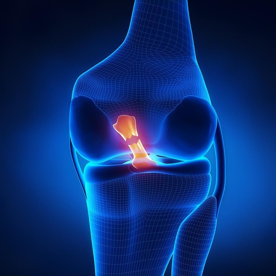 Lésion ligamentaire - Dr Latif Vaqar