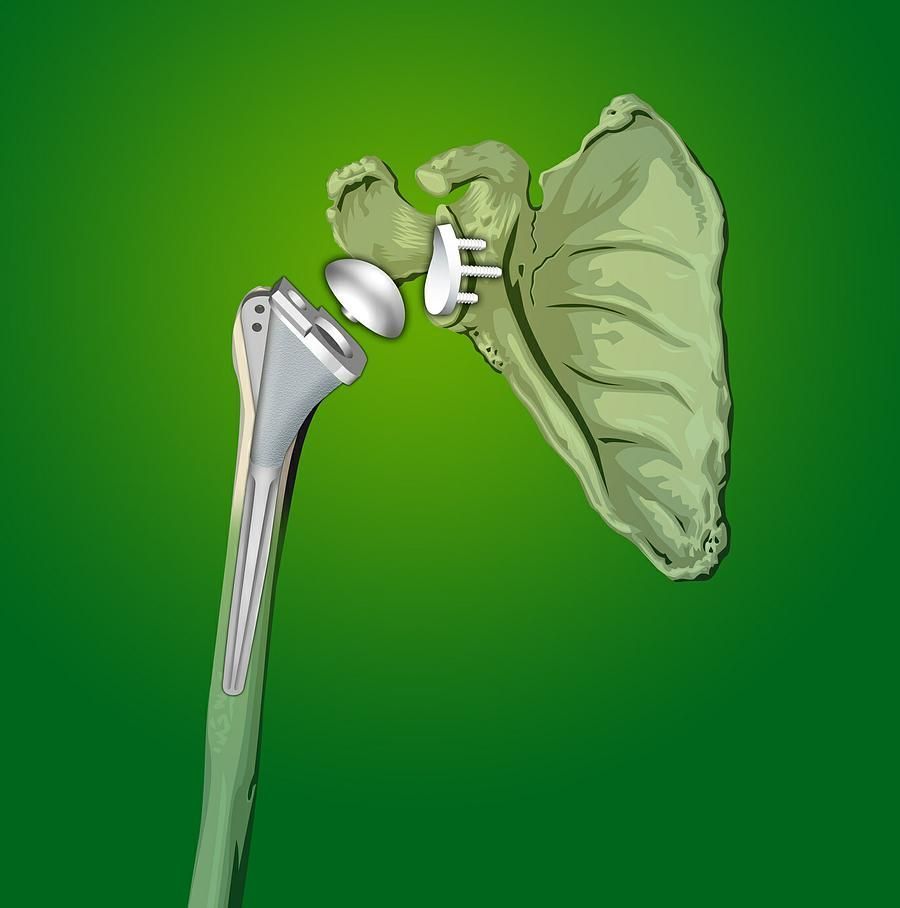 rhumatismes inflammatoires - Dr Latif Vaqar