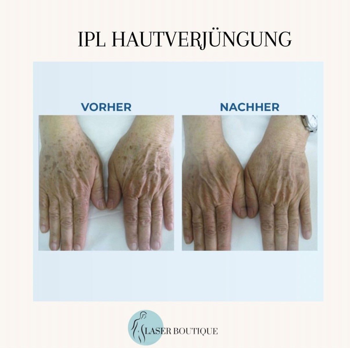Ein Vorher-Nachher-Bild der Hände einer Person.