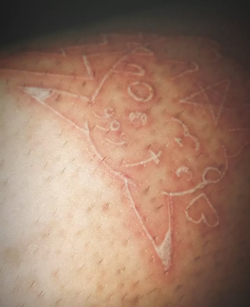 Cicatriz blanca de un personaje de dibujos animados en la piel. Incluye rostro, orejas y detalles en forma de estrella.